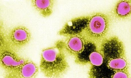 ¿Cuáles son los síntomas del coronavirus en humanos?